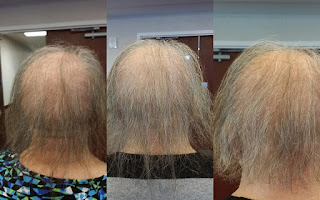 monat before and after reviews