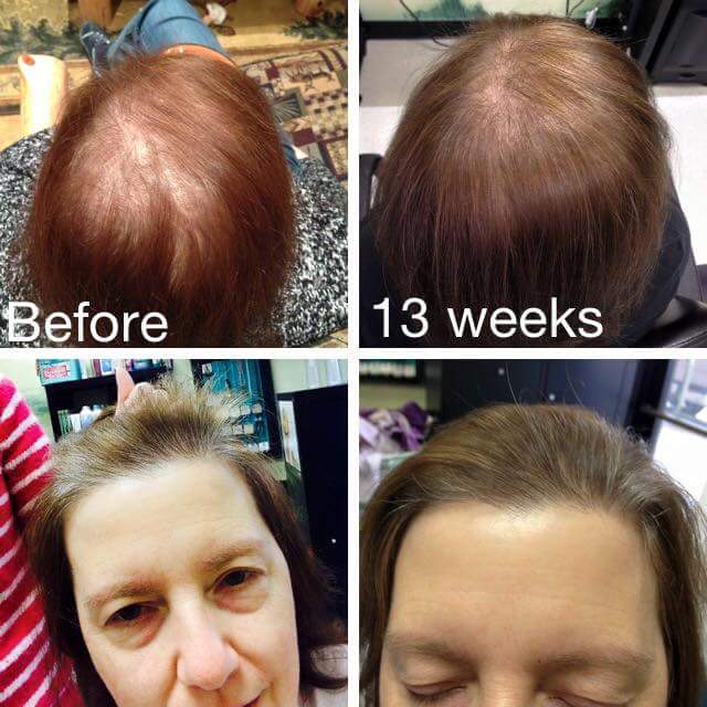 monat before and after reviews